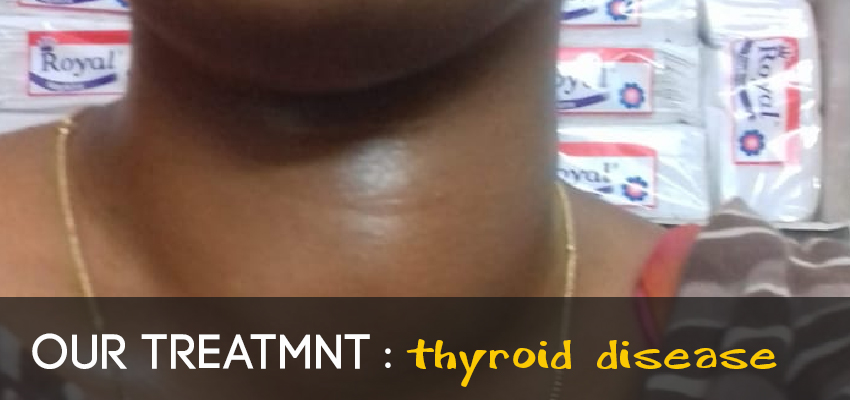 reflexology-treatment-thyroid